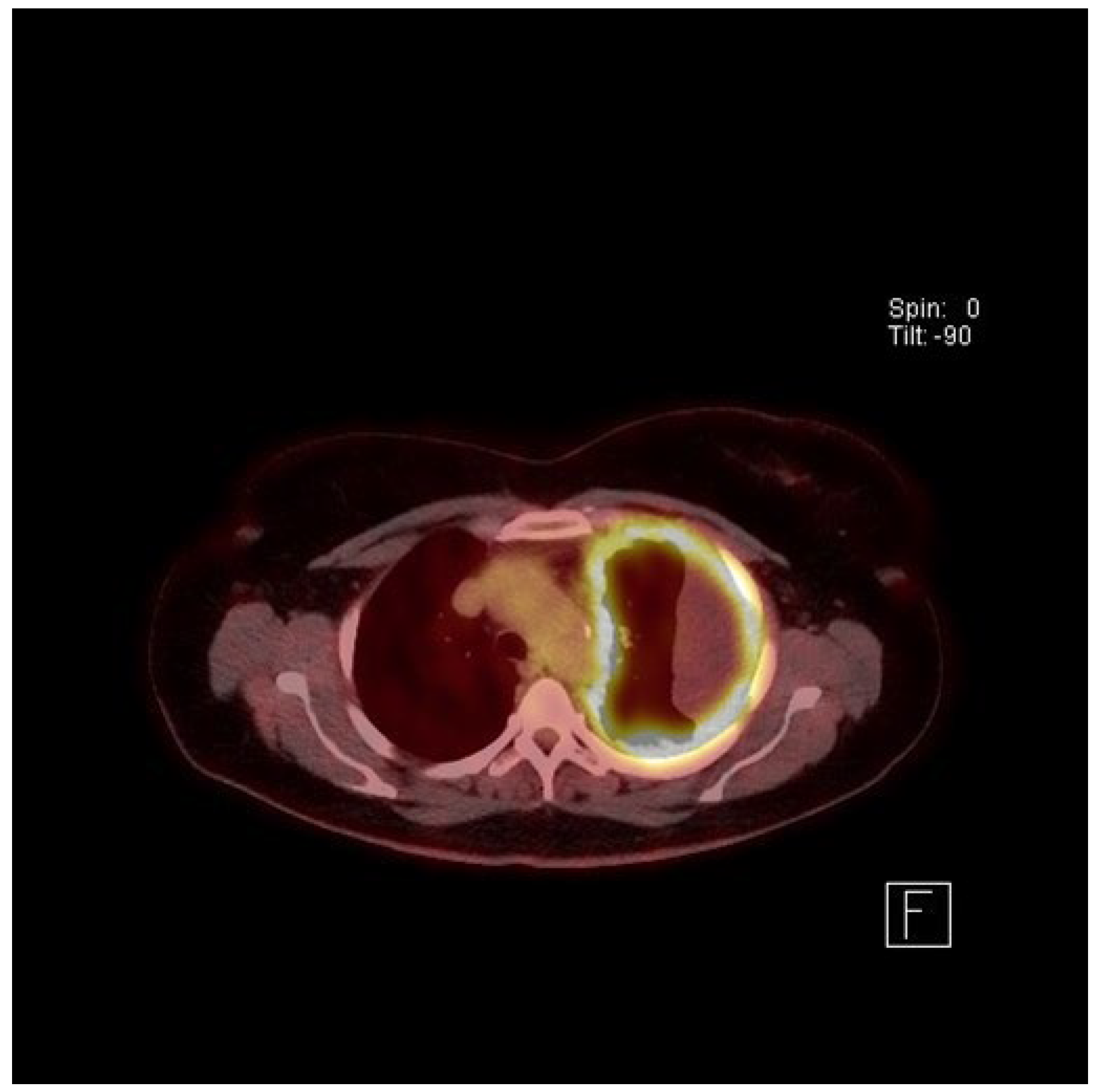 Mesothelioma Claims Process	Informational